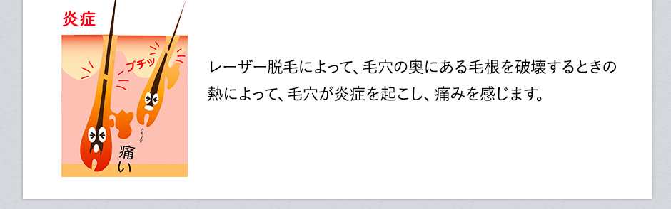 レーザー脱毛によって、毛穴の奥にある毛根を破壊するときの熱によって、毛穴が炎症を起こし痛みを感じます。