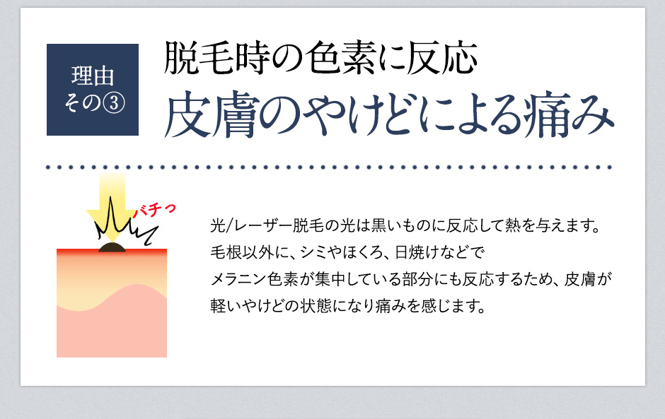 脱毛が痛い理由③皮膚のやけど