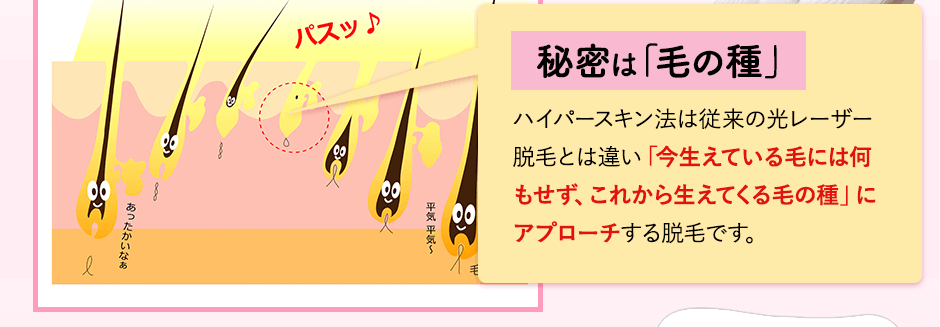 秘密は毛の種。ハイパースキン法は従来の光レーザー脱毛とは違い「今生えている毛には何もせず、これから生えてくる毛の種」にアプローチして脱毛する脱毛です。