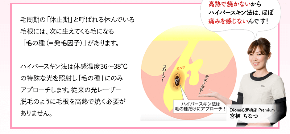 ハイパースキン法は毛の種だけにアプローチ。高熱で焼かないからハイパースキン法はほぼ痛みを感じないんです。ディオーネ心斎橋店宮植ちなつ。毛周期の「休止期」と呼ばれる休んでいる毛根には、次に生えてくる毛になる「毛の種（＝発毛因子）」があります。ハイパースキン法は体感温度36～38℃の特殊な光を照射し「毛の種」にのみアプローチします。従来の光レーザー脱毛のように毛根を高熱で焼く必要がありません。