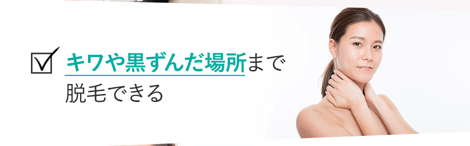 キワのキワや黒ずんだ場所まで脱毛できる