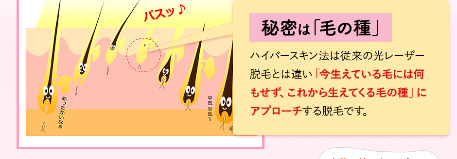 秘密は毛の種。ハイパースキン法は従来の光レーザー脱毛とは違い「今生えている毛には何もせず、これから生えてくる毛の種」にアプローチして脱毛する脱毛です。